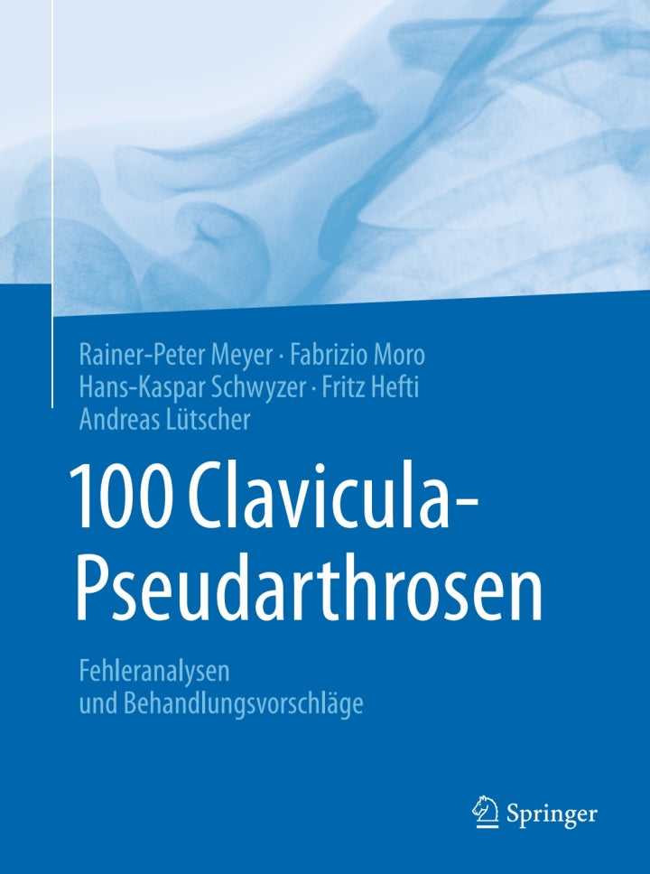 100 Clavicula-Pseudarthrosen Fehleranalysen und Behandlungsvorschläge